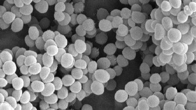 Multiresistente MRSA-Bakterien