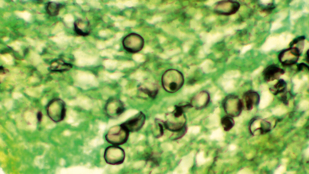 Mikrobiologie Pneumocystis – ein eigenartiger Pilz!