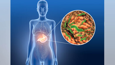 Symbolbild für Helicobacter pylori im Magen.