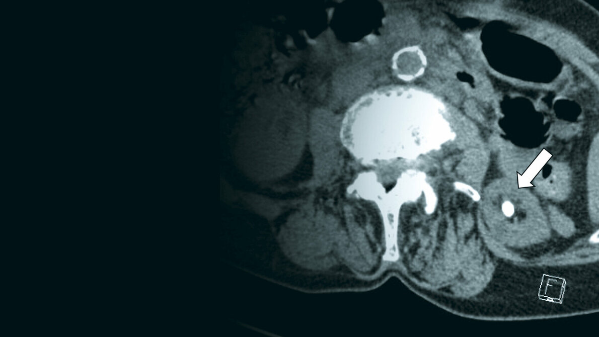 Bildgebende Verfahren
