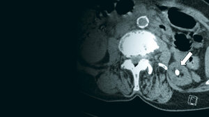 Bildgebende Verfahren