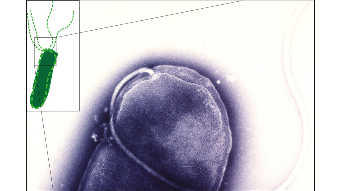 EM-Aufnahme von Helicobacter pylori