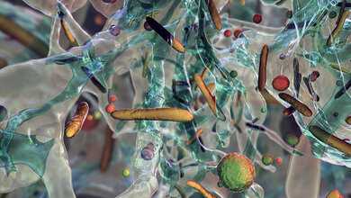 Multiresistente Keime: Studie zeigt Unterschiede in der Verbreitung