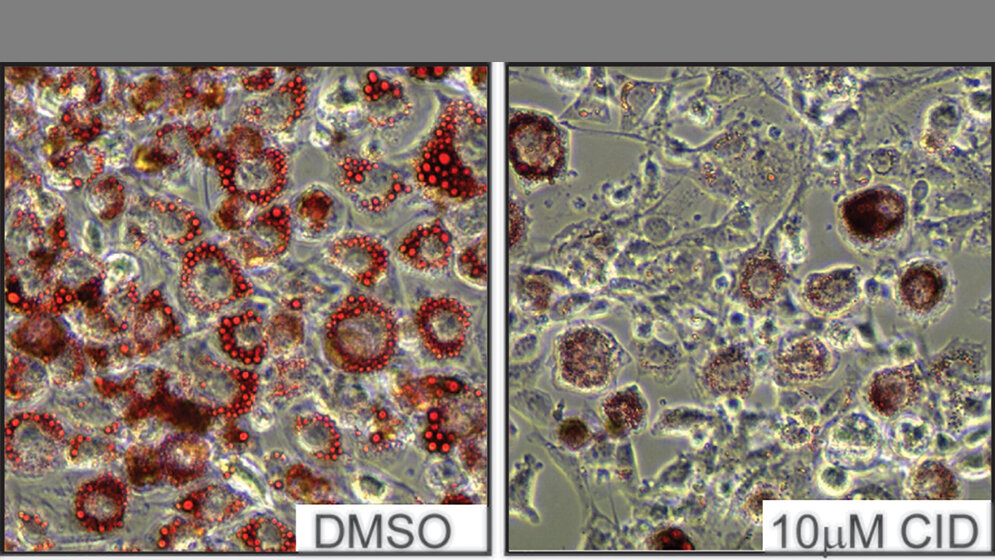 Fettzellen_Mona_Loeffler_Rudolf_Virchow_Zentrum_der_Uni_Wuerzburg.jpg Fettzellen
