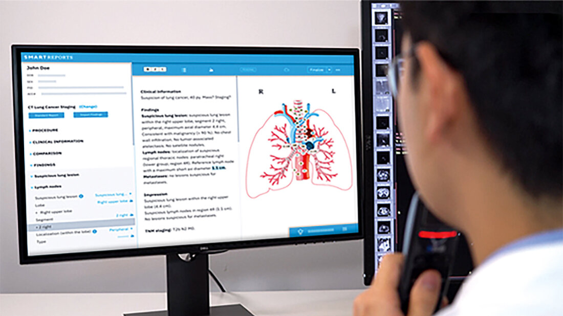 Foto der Software Smart Reporting