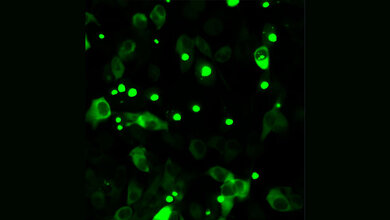 Huntington_Y_Richter.jpg Humane Zellen, die fluoreszenz-markiertes mutiertes Huntingtin herstellen.