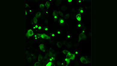 Humane Zellen, die fluoreszenz-markiertes mutiertes Huntingtin herstellen. 