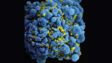 Let’s say it in English HIV/AIDS