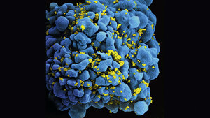 HIV/AIDS