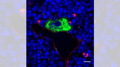 Mikroskopaufnahme_von_intaktem_Knochenmarkgewebe_AG_Nieswandt.jpg Mikroskopaufnahme von intaktem Knochenmarkgewebe