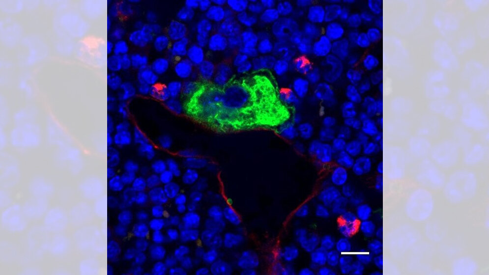 Mikroskopaufnahme von intaktem Knochenmarkgewebe