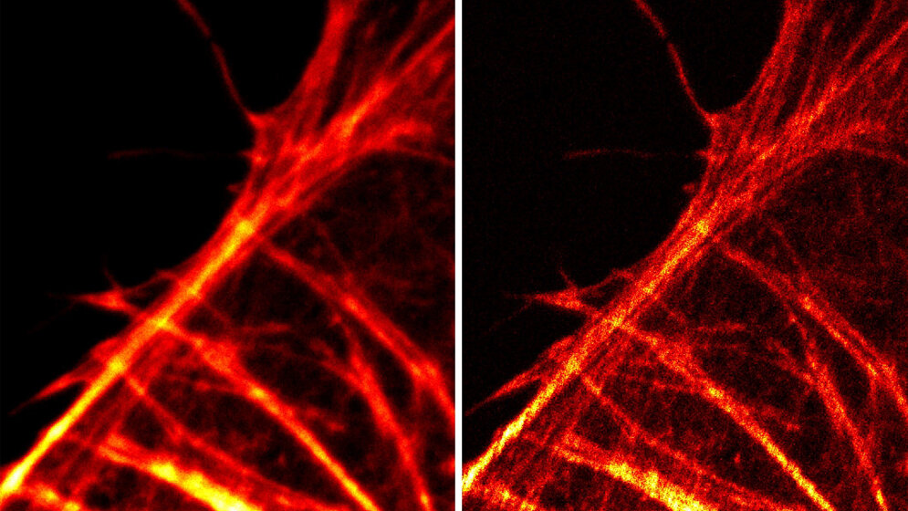 Mikroskopieaufnahmen zeigen Aktinfilamente 