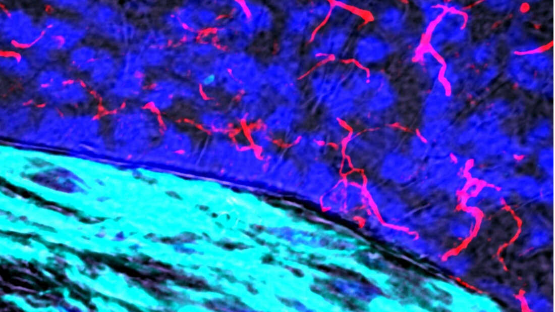 Nervennetzwerk_rot_in_erkrankter_Arterie_LMU.jpg Nervennetzwerk (rot) in erkrankter Arterie