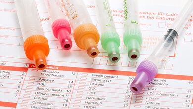 Entnahmeröhrchen für das Labor