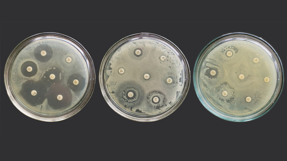 Antibiogramm.jpg Antibiogramm