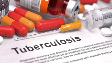 Let’s say it in English Pulmonary Tuberculosis