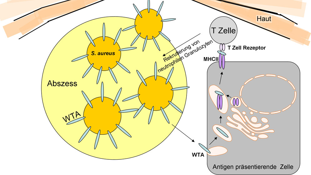 Das_Zellhuellen_Zuckerpolymer_Wandteichonsaeure_Uni_Tuebingen.jpg Zellhüllen-Zuckerpolymer Wandteichonsäure