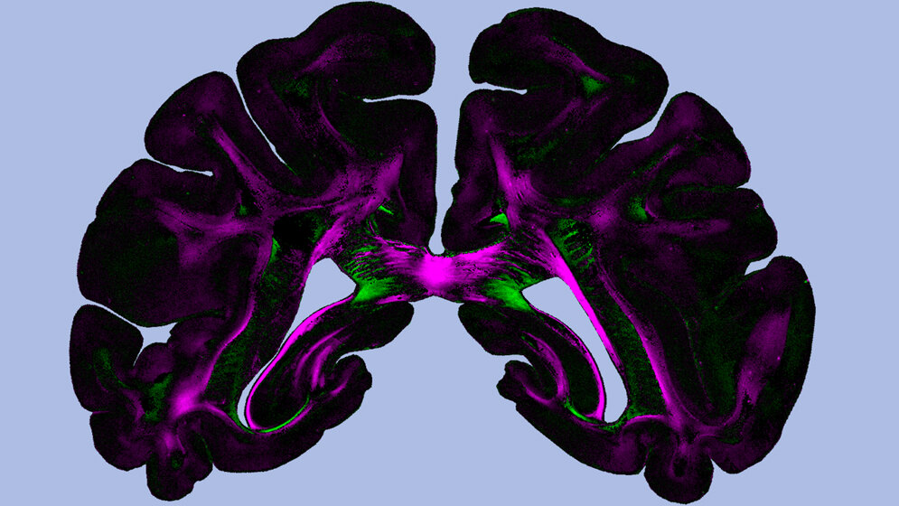 „Diattenuation Imaging“ (DI)