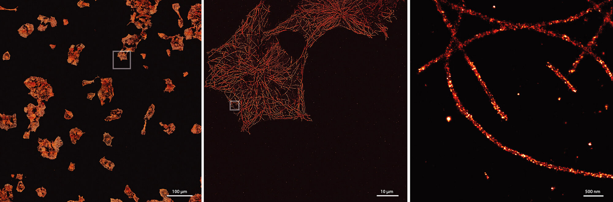 Die superauflösende Mikroskopietechnik DNA-PAINT