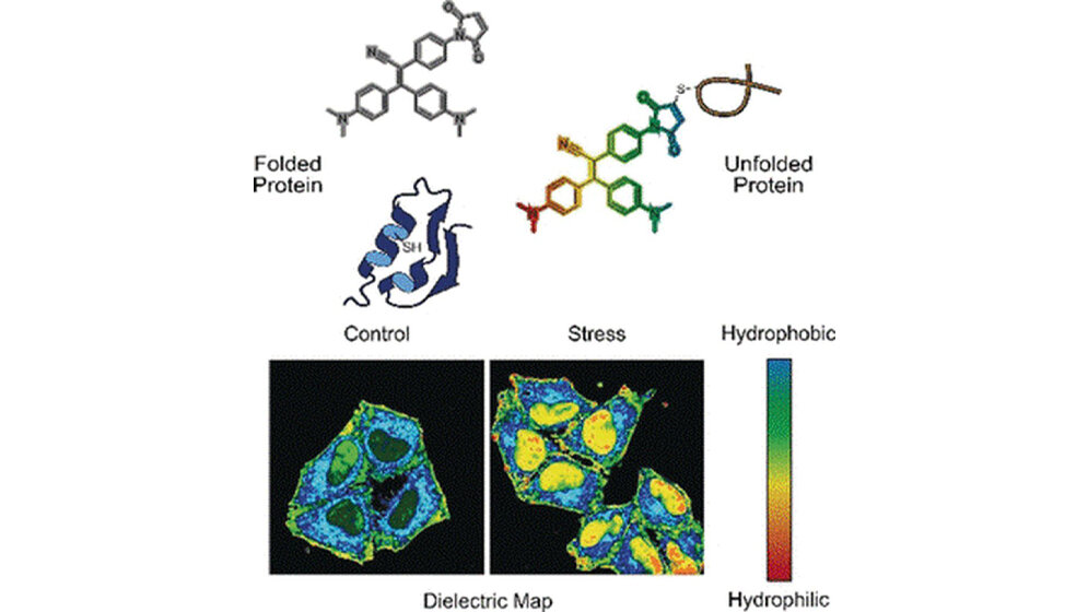 Sonde bindet an die fehlgefalteten Proteine