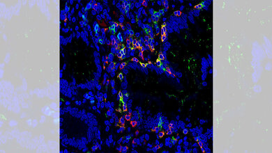 TRM-Zellen (in der Aufnahme gelb)