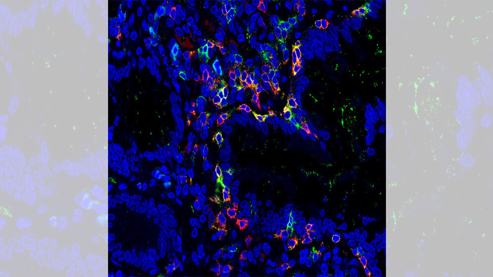 TRM-Zellen (in der Aufnahme gelb)
