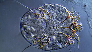 Sexually Transmitted Diseases (III)