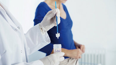 Verbessertes Zervixkarzinom-Screening