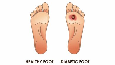 Wirkungsmechanismen der Kaltplasmatherapie 