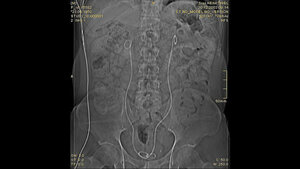 Schnittbilddiagnostik der Wirbelsäule (4.17)