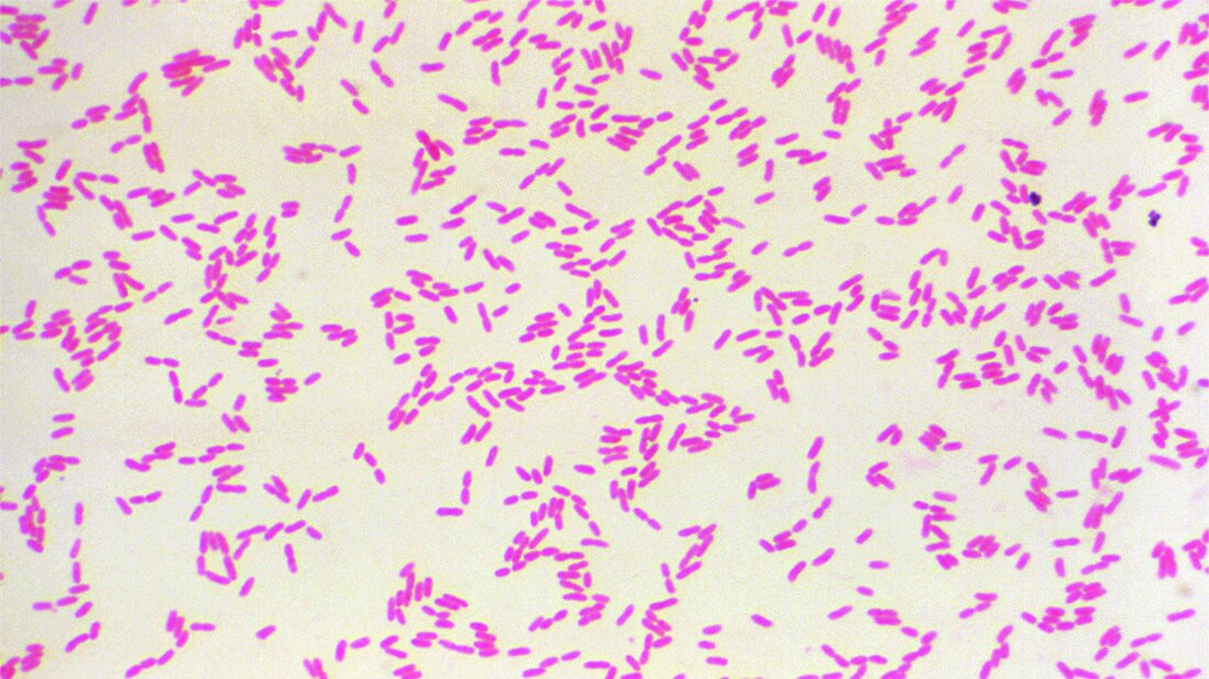 Burkholderia pseudomallei unter dem Mikroskop