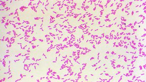 Burkholderia pseudomallei unter dem Mikroskop