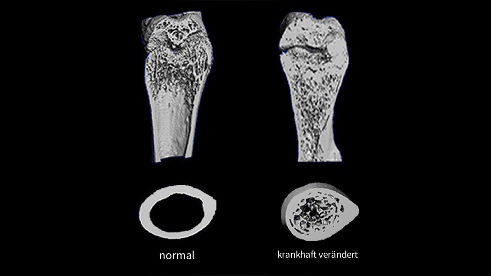 Marmorknochenkrankheit_Osteopetrose_Gruppe_Waskow_FLI.jpg Marmorknochenkrankheit (Osteopetrose)