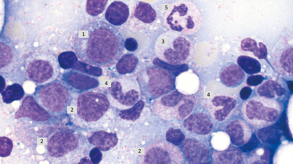 Granulopoese Reifung und Regulation