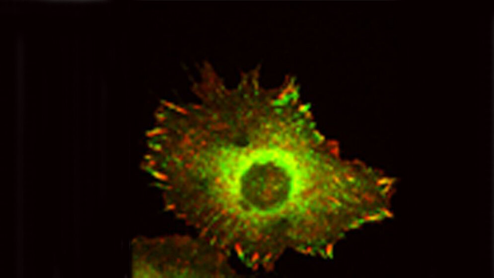 Cadherin-11 