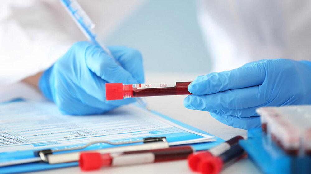Nahaufnahme von Händen in blauen Handschuhen, die eine Blutprobe in einem Röhrchen halten, mit medizinischen Unterlagen und weiteren Proben im Hintergrund.