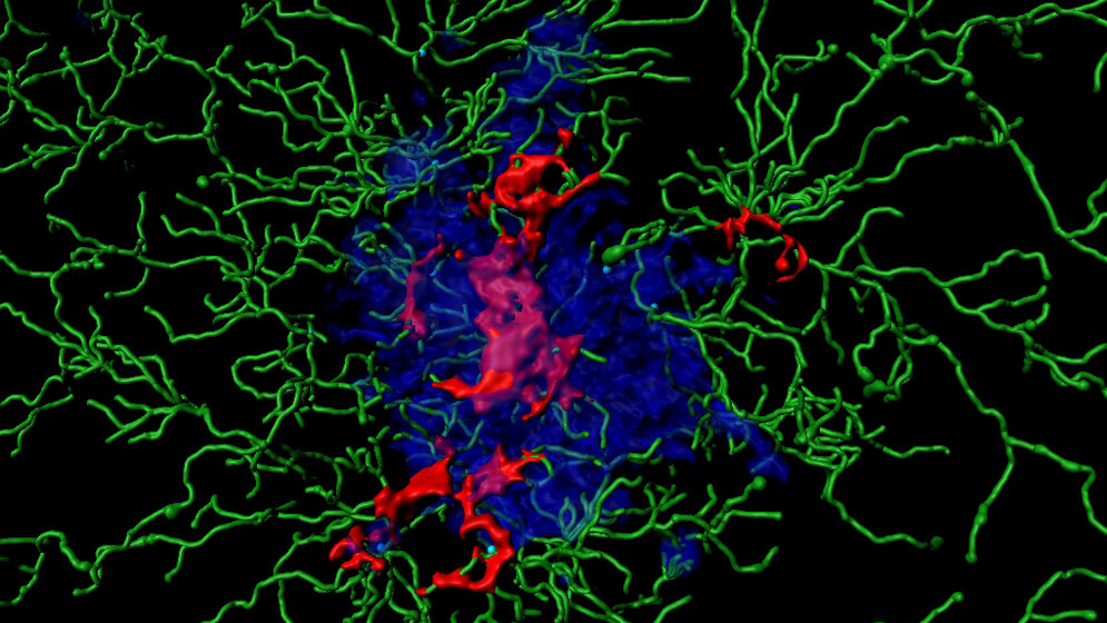 Entzündungsproteine, sogenannte ASC Specks