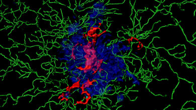 Entzündungsproteine, sogenannte ASC Specks