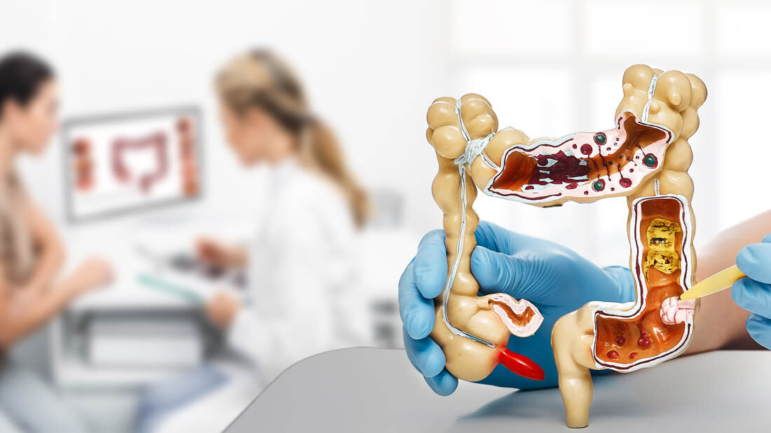 Erblicher_Darmkrebs.jpg Darmkrebs