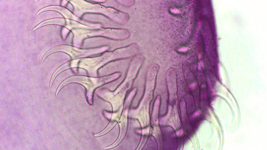 Bandwurm Taenia species 