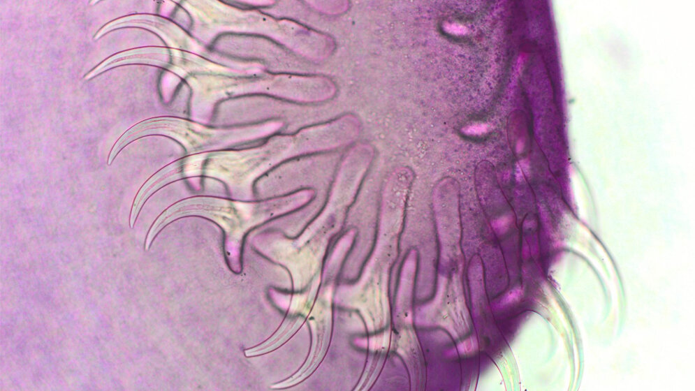 Bandwurm Taenia species 