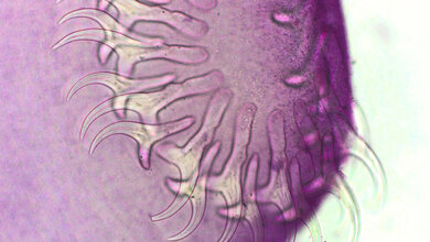 Bandwurm Taenia species 