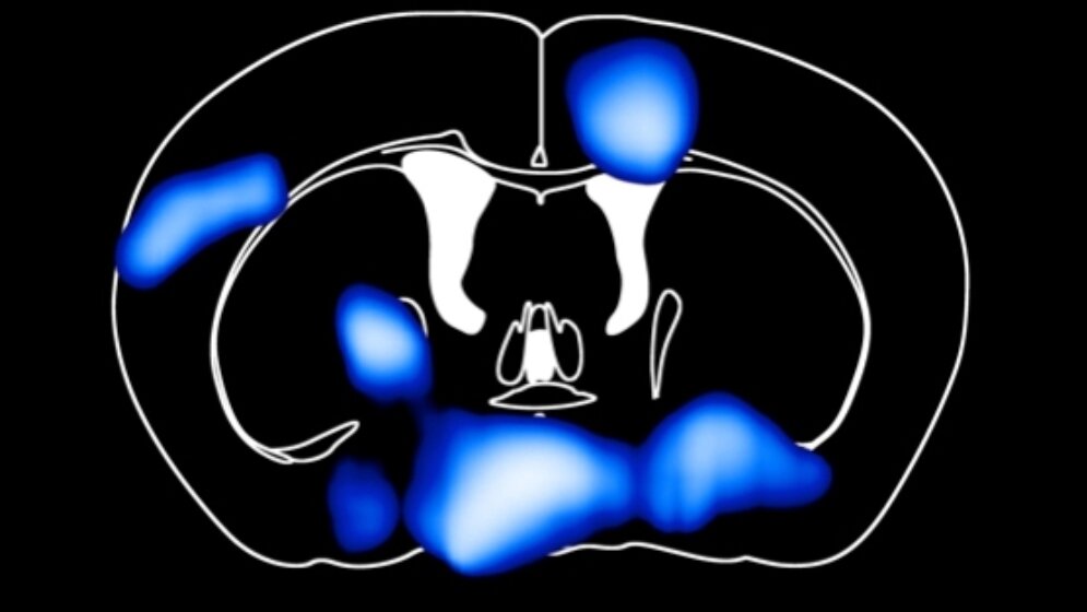 Querschnitt durchs Mausgehirn