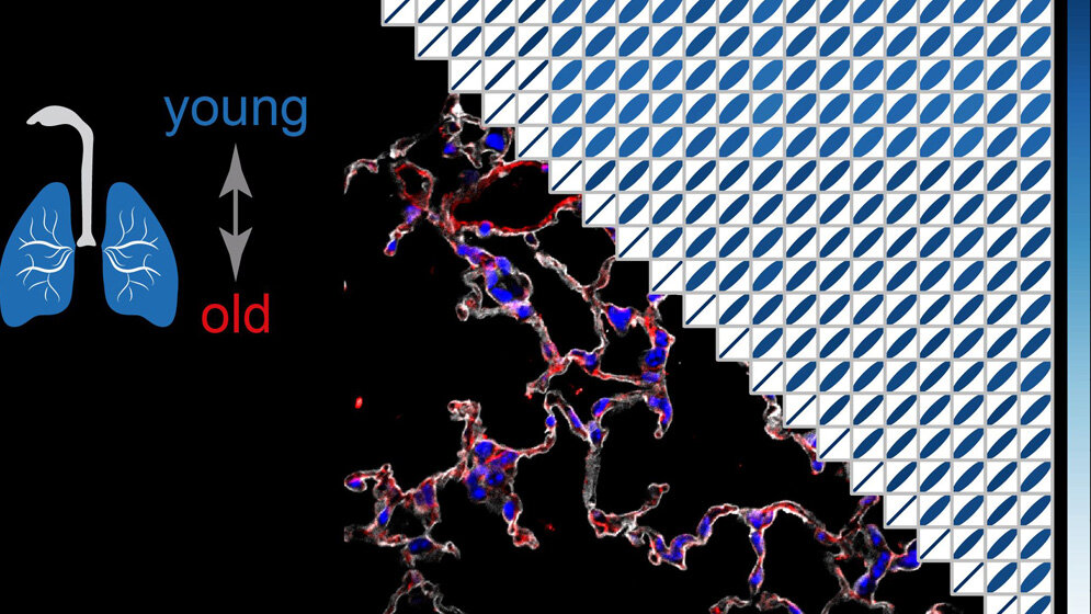 Multi_omics_Analyse_der_Lungenalterung_Helmholtz_Zentrum_Muenchen.jpg Multi-omics Analyse der Lungenalterung