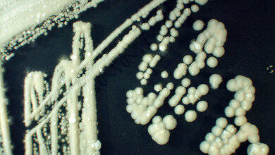 Die Rolle der Sprosspilze in der Medizin (Teil III)