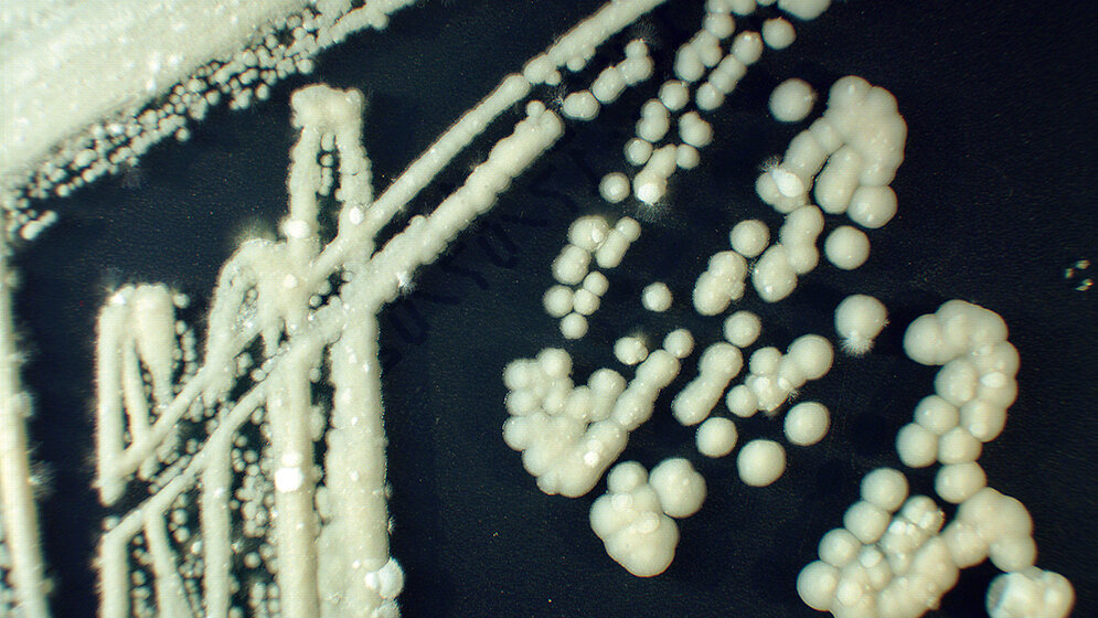Mikrobiologie Die Rolle der Sprosspilze in der Medizin (Teil III)