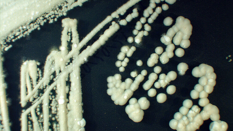 Die Rolle der Sprosspilze in der Medizin (Teil III) MTDialog