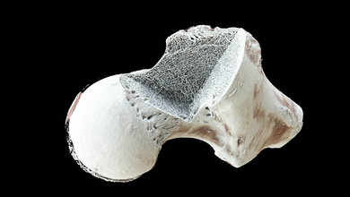 Micro-CT-Aufnahme eines Oberschenkelhalses
