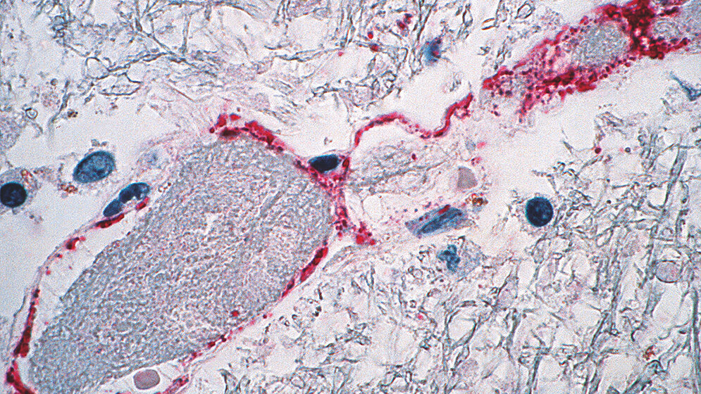Nipah Virus