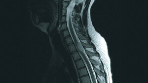 Schnittbilddiagnostik der Wirbelsäule